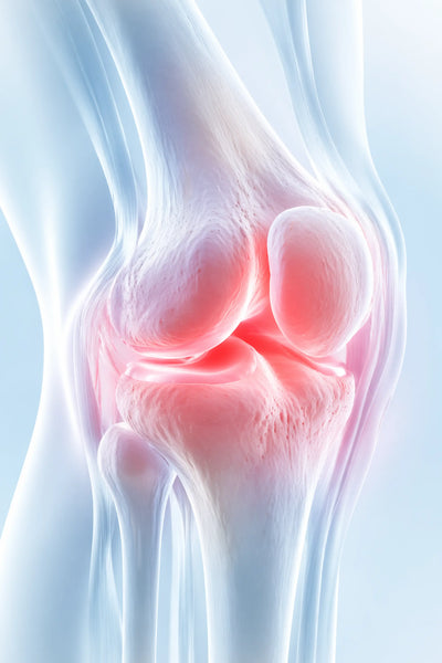 Calms Inflamed Joints